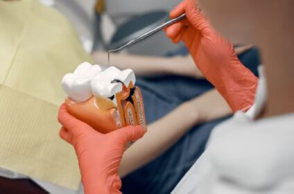 root canal treatment in Noida